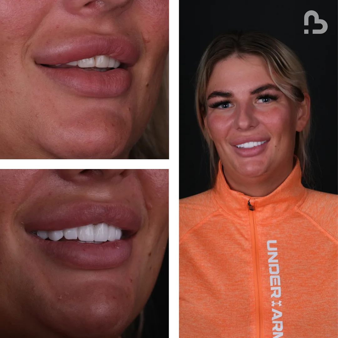 Before and after result 5