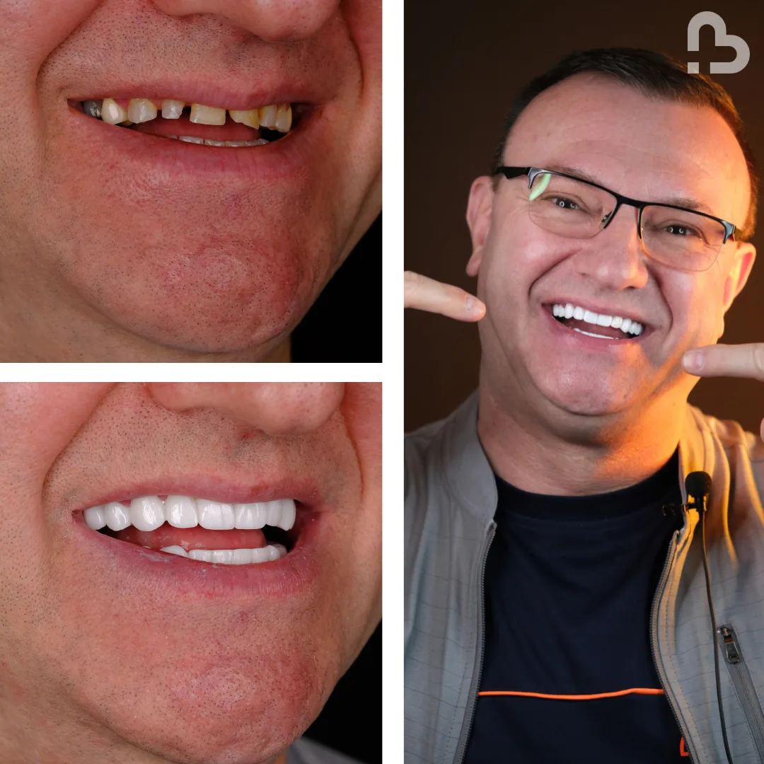 Before and after result 6
