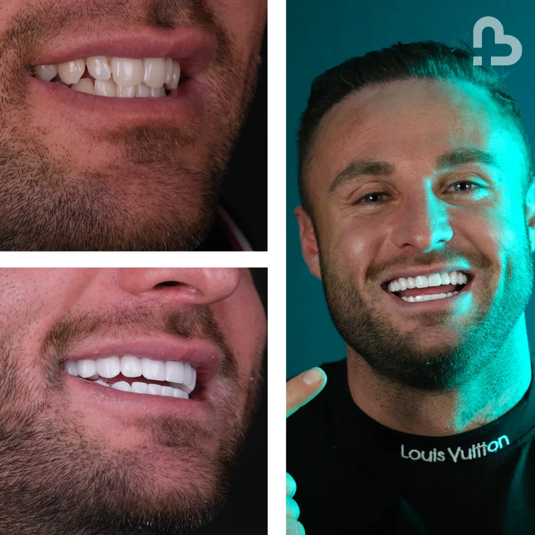 Before and after result 7