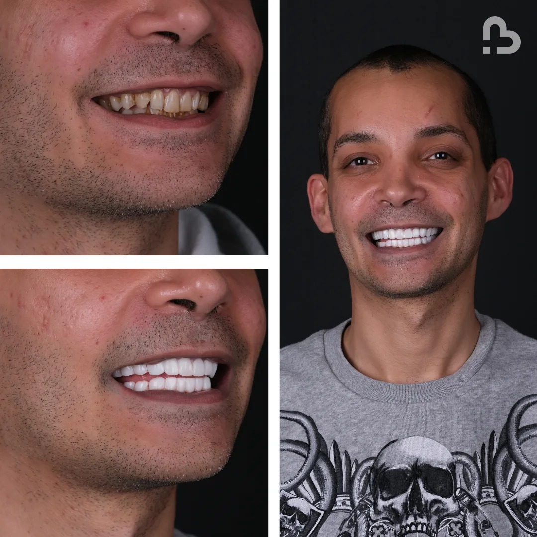 Before and after result 8