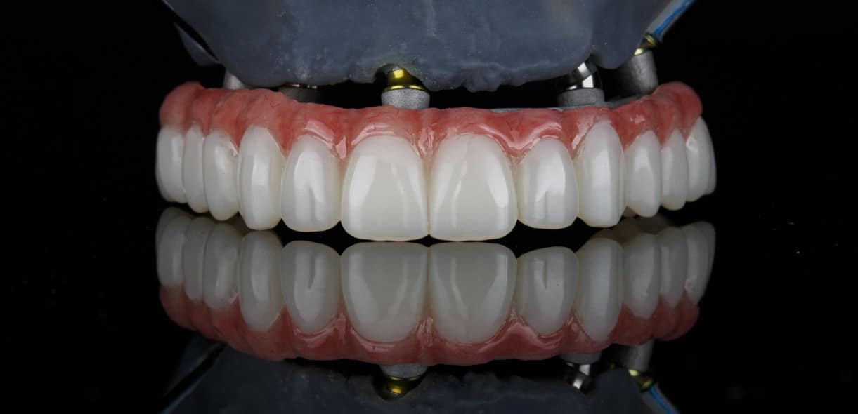 Dental Treatments